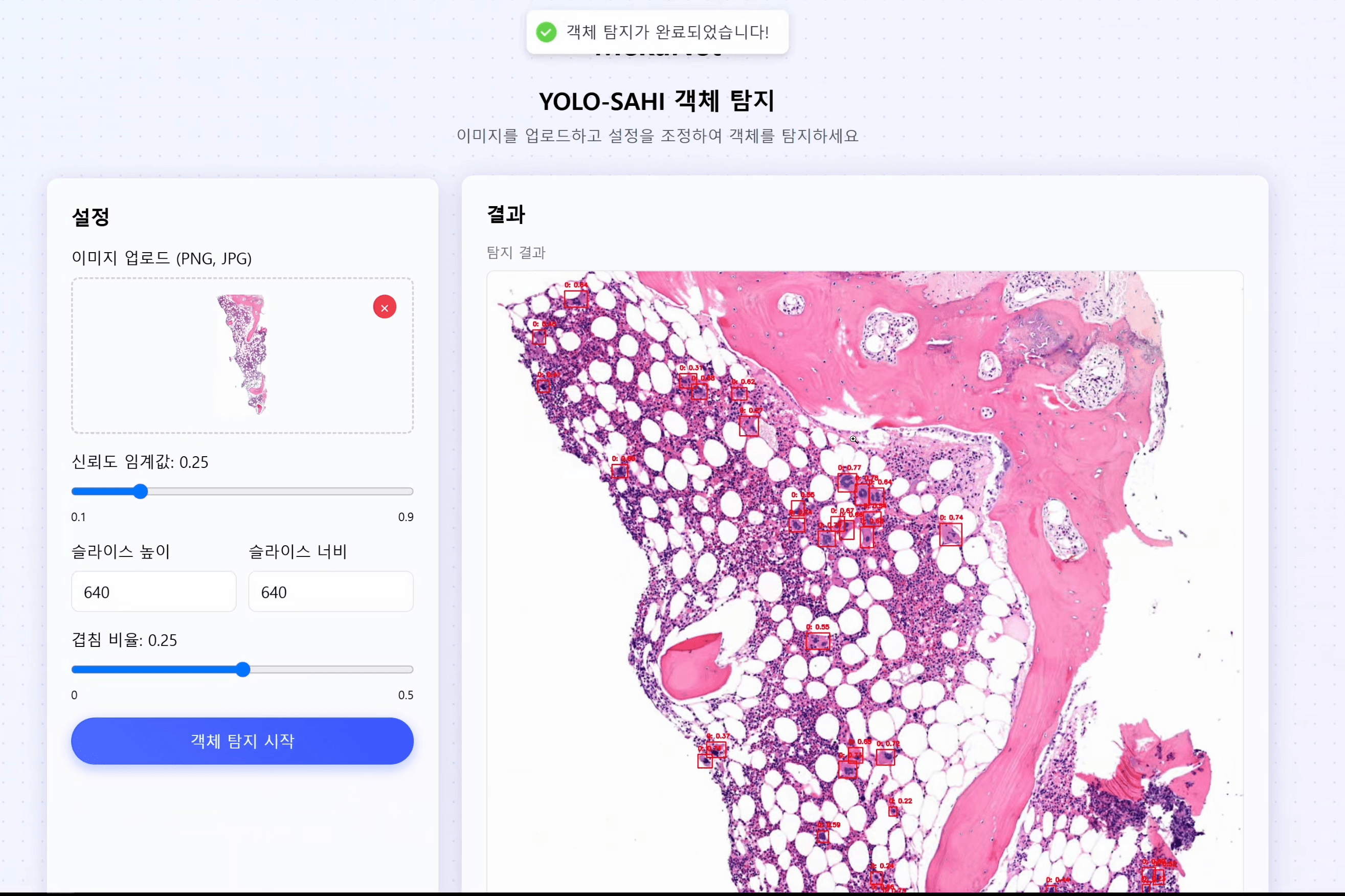 MekaNet: A Tiling-Enhanced Semi-Supervised Detection Framework for Megakaryocytes